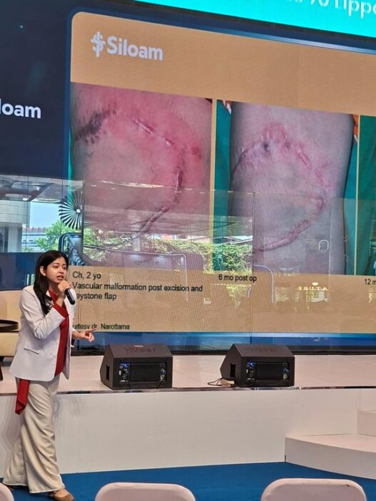 Perdana Bedah Plastik, Rekonstruksi dan Estetik dengan Standar Korea Selatan di Siloam Hospital TB Simatupang