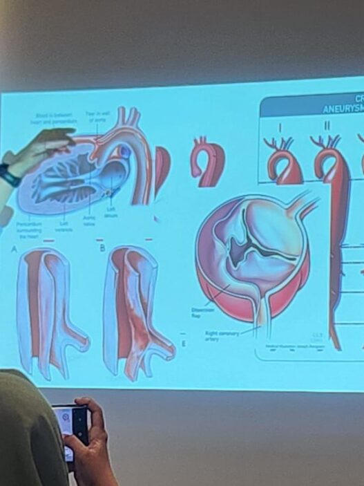 Kecepatan Menjadi Kunci Penyelamatan Nyawa pada Penanganan Penyakit Aorta Kompleks di Era Modern